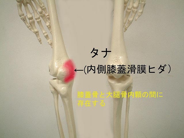 ひだ 障害 膜 滑 【膝の痛み】滑膜ひだ障害（タナ障害）の症状・原因・治療まとめ